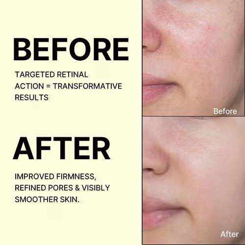 Celimax The Vita-A Retinal Shot Tightening Booster, For Anti-Aging, Dark Spots & Wrinkles